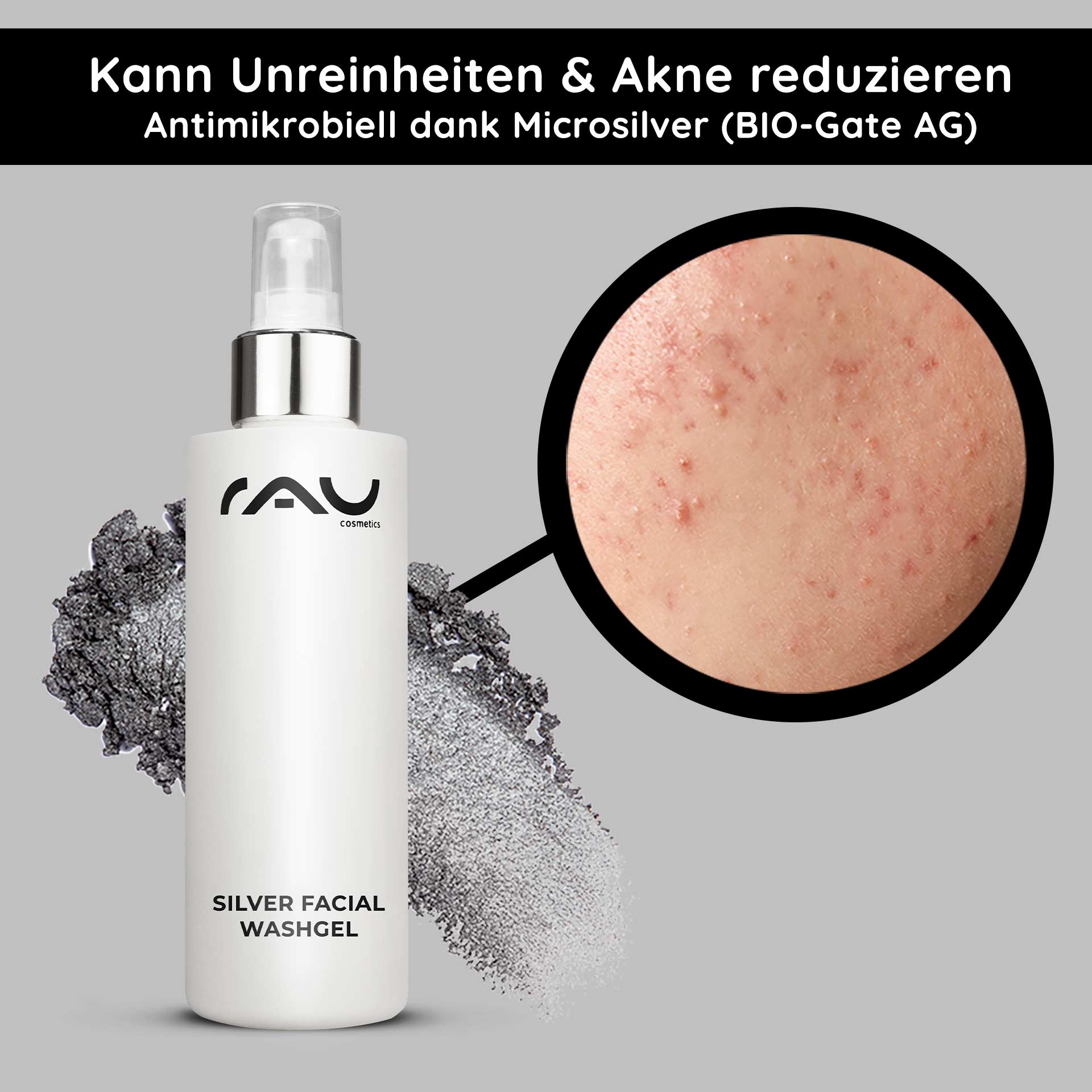 シルバー・フェイシャル・ウォッシュジェル 200ml マイクロシルバークレンザー Flasche RAU Silver Facial Washgel mit antimikrobiellem Mikrosilber, Nahaufnahme von Haut mit Akne und Unreinheiten, mit Hervorhebung der Vorteile für empfindliche und zu Akne neigende Haut.