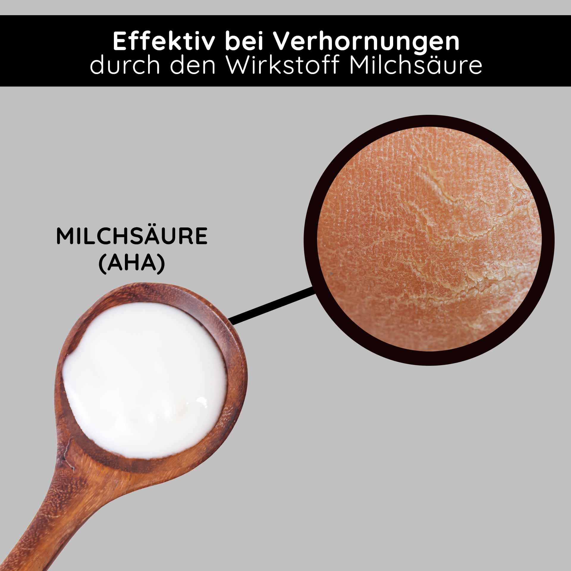 フルーツ酸&BHAクリーム 50ml - BHAフルーツ酸クリーム Milchsäure (AHA) in einem Holzlöffel, wirksam gegen Verhornungen, mit Hauttextur im Detail.