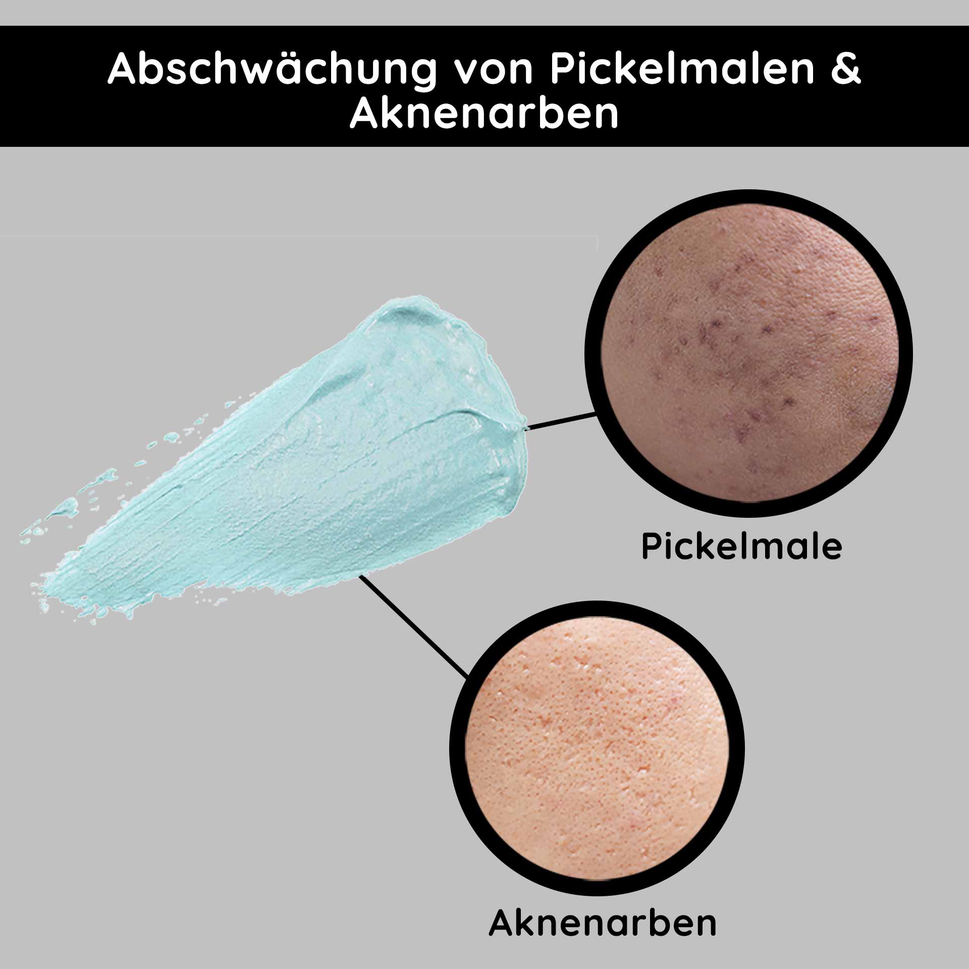 O2 リッチクリーム 200ml リッチ&フレグランス Abschwächung von Pickelmalen und Aknenarben mit blauer Creme, Vergleich von Hauttexturen für Hautpflegeprodukte.