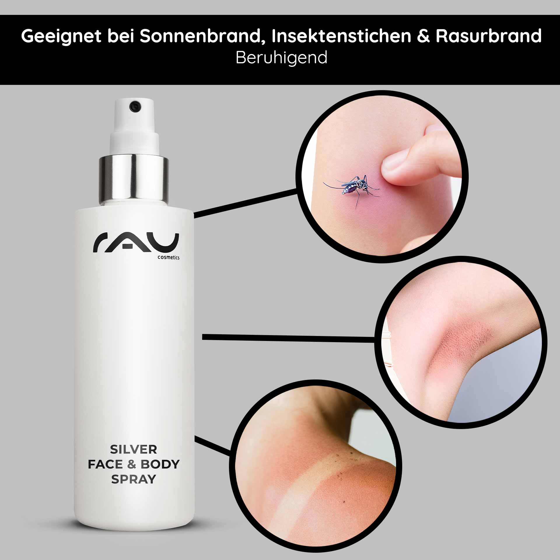 シルバーフェイス&ボディスプレー 200ml パンテノール&マイクロシルバー配合 Silver Face & Body Spray von RAU Cosmetics, geeignet zur Linderung von Sonnenbrand, Insektenstichen und Rasurbrand, mit sichtbaren Beispielen für Hautirritationen und einem eleganten Sprühflaschendesign.