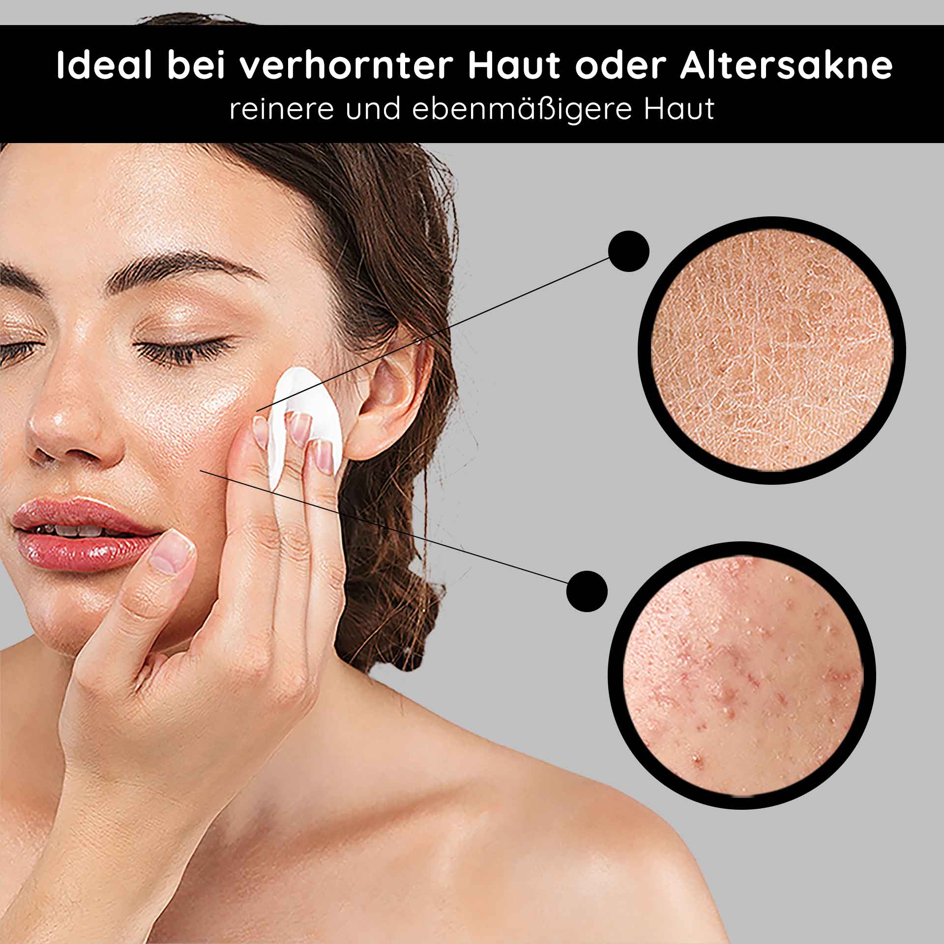 AHAトニック1000mlマイルドフルーツ酸トニック Frau mit Wattepad, das AHA Tonic auf Gesicht aufträgt, ideal bei verhornter Haut oder Altersakne, zeigt Hautunreinheiten und Texturverbesserung.