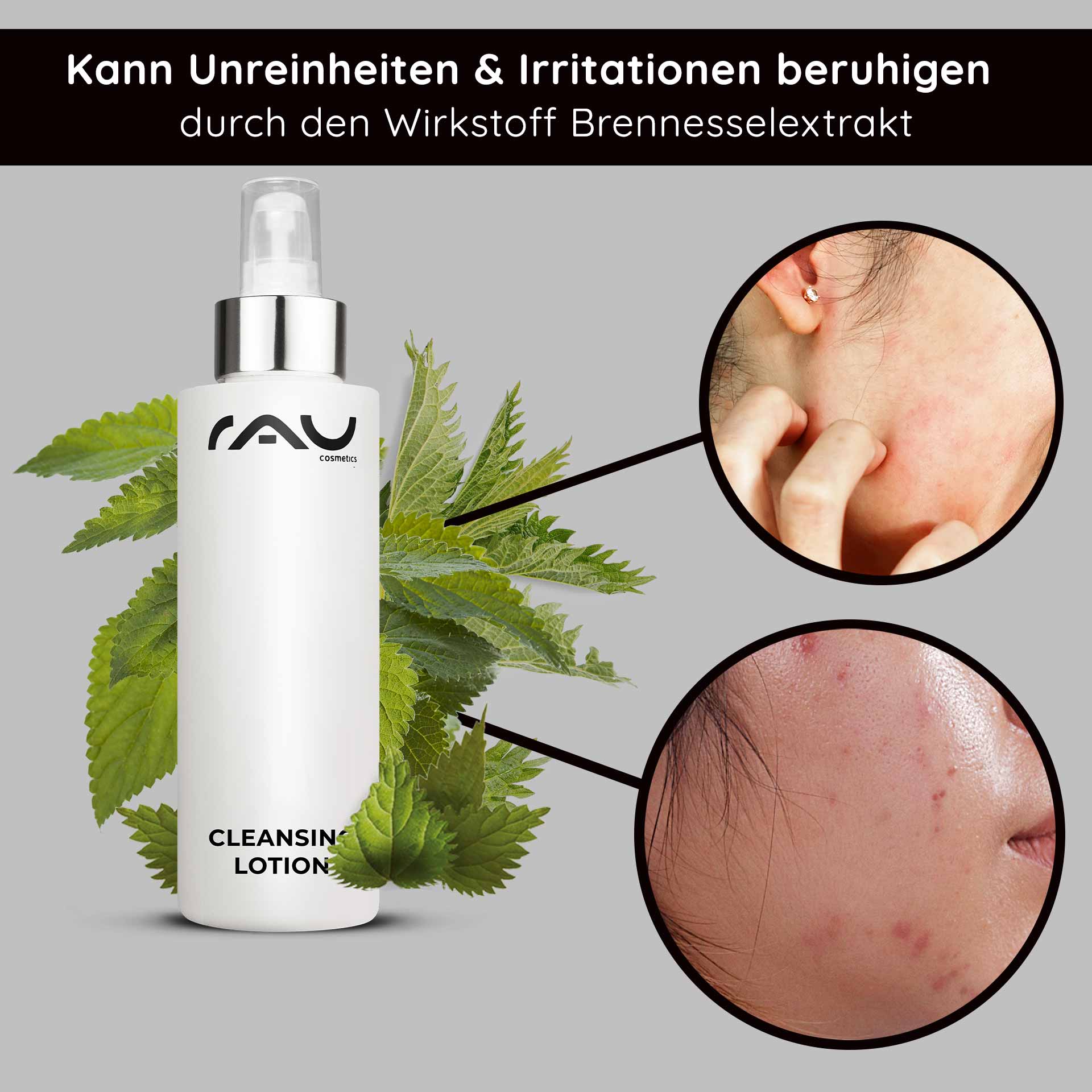 クレンジング・ローション 200ml - 徹底的なクレンジング・ローション Flasche der RAU-Reinigungslotion mit Brennnesselblättern im Hintergrund, die die Vorteile bei der Linderung von Unreinheiten und Reizungen hervorhebt und Nahaufnahmen von Haut mit Unreinheiten zeigt.